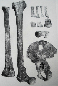 <p>Bones of the